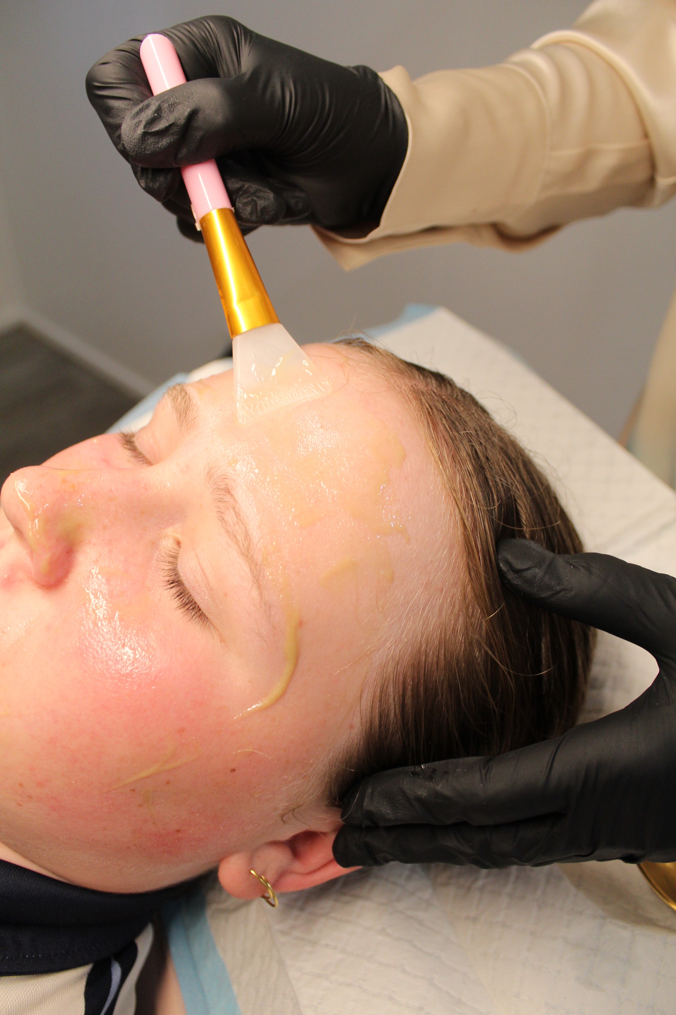 TEEN FACIAL