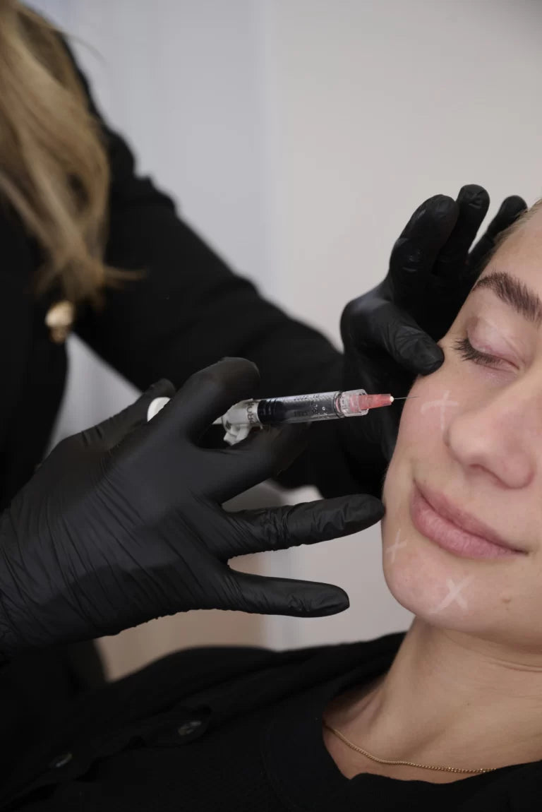 A model receiving cheek filler treatment at Mel Hornery Cosmetics. The close-up shows a skilled professional injecting dermal filler into the model's cheek to enhance facial contours.