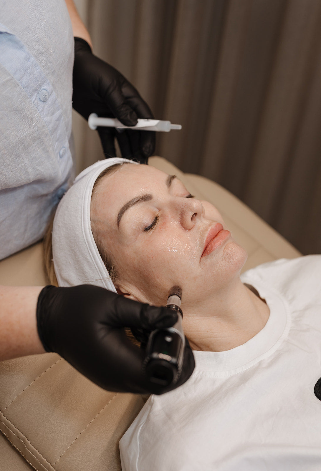 4x Skin Needling (With Age-Defying Dermal Infusion)