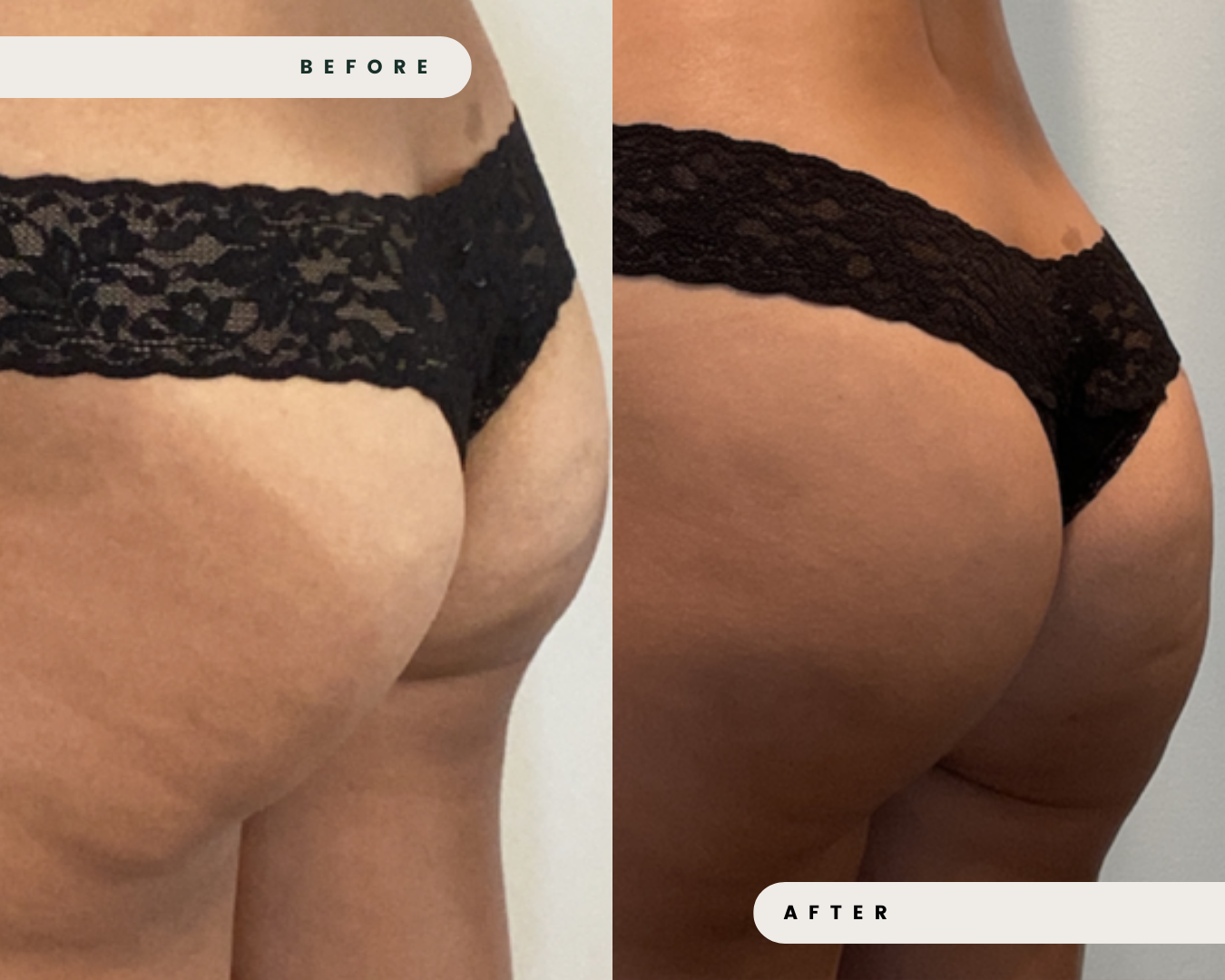 TRUFLEX_MUSCLE_TONING_1_5b5ca715-0913-4ef8-9dee-05dc399023b9.png