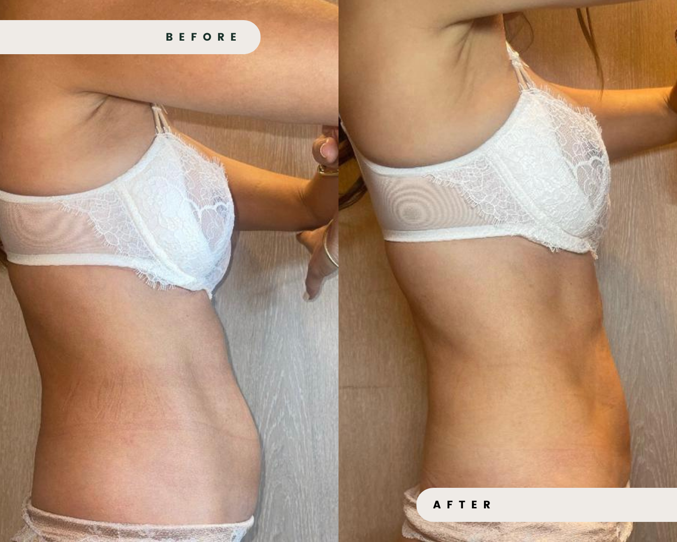 TRUFLEX_MUSCLE_TONING_5_eb6d5eb8-32f9-430b-8f77-aa45fc0ef452.png
