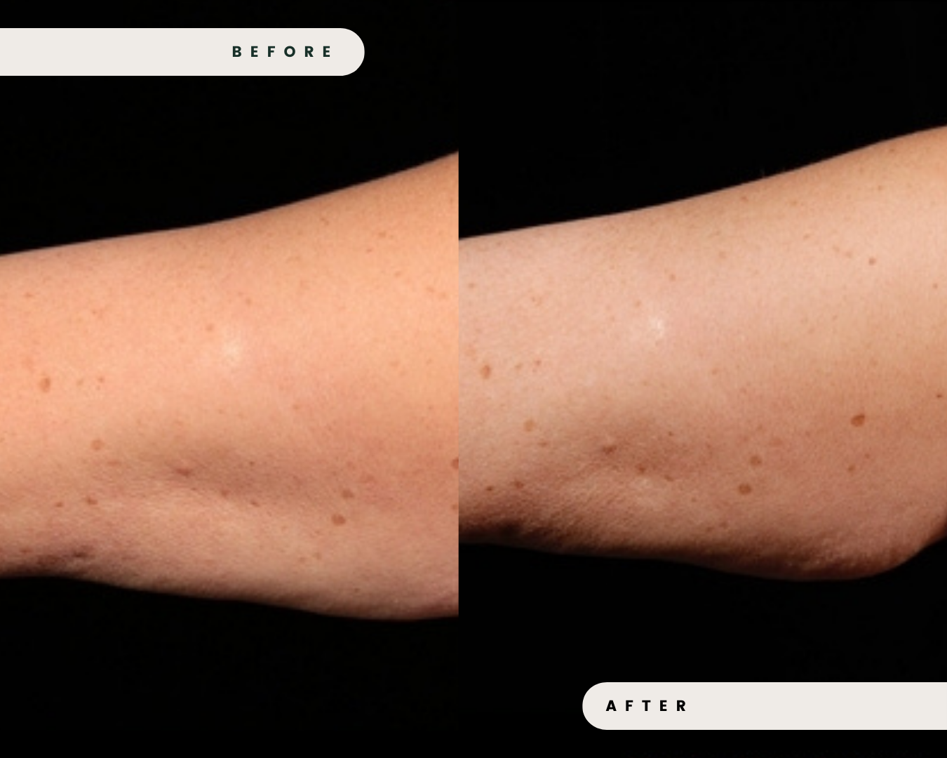 TRUSCULPT_FAT_REDUCTION_2_e0d6ca9c-3ed1-4ff1-9207-5d0e34632526.png