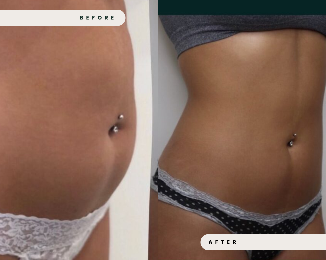 TRUSCULPT_FAT_REDUCTION_5_fa53dd10-8df5-4ead-a30e-72f3567d9934.png