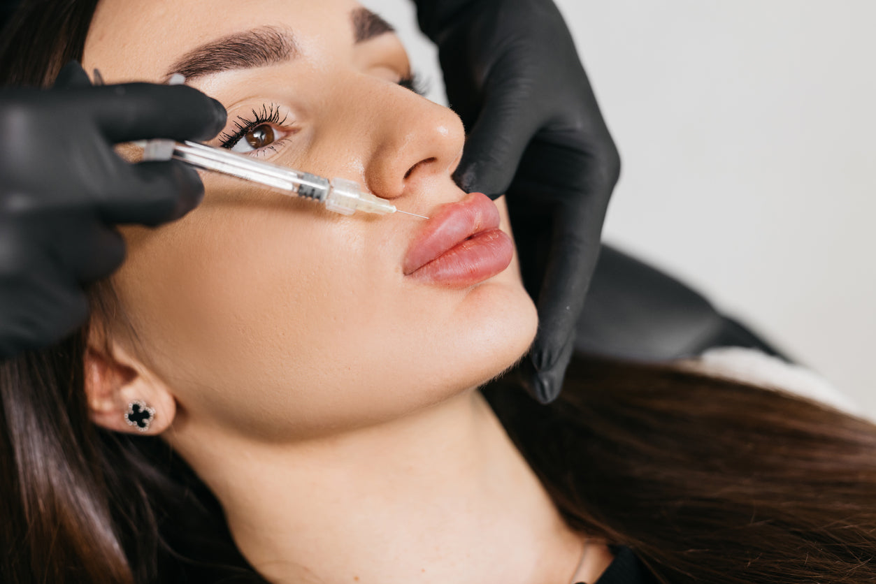 Model receiving a dermal filler dissolver treatment at Mel Hornery Cosmetics, showcasing professional and safe dermal filler removal services.